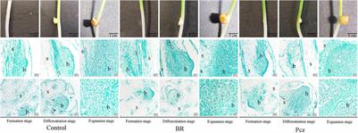 Regulation Mechanism of Exogenous Brassinolide on Bulbil Formation and Development in Pinellia ternata